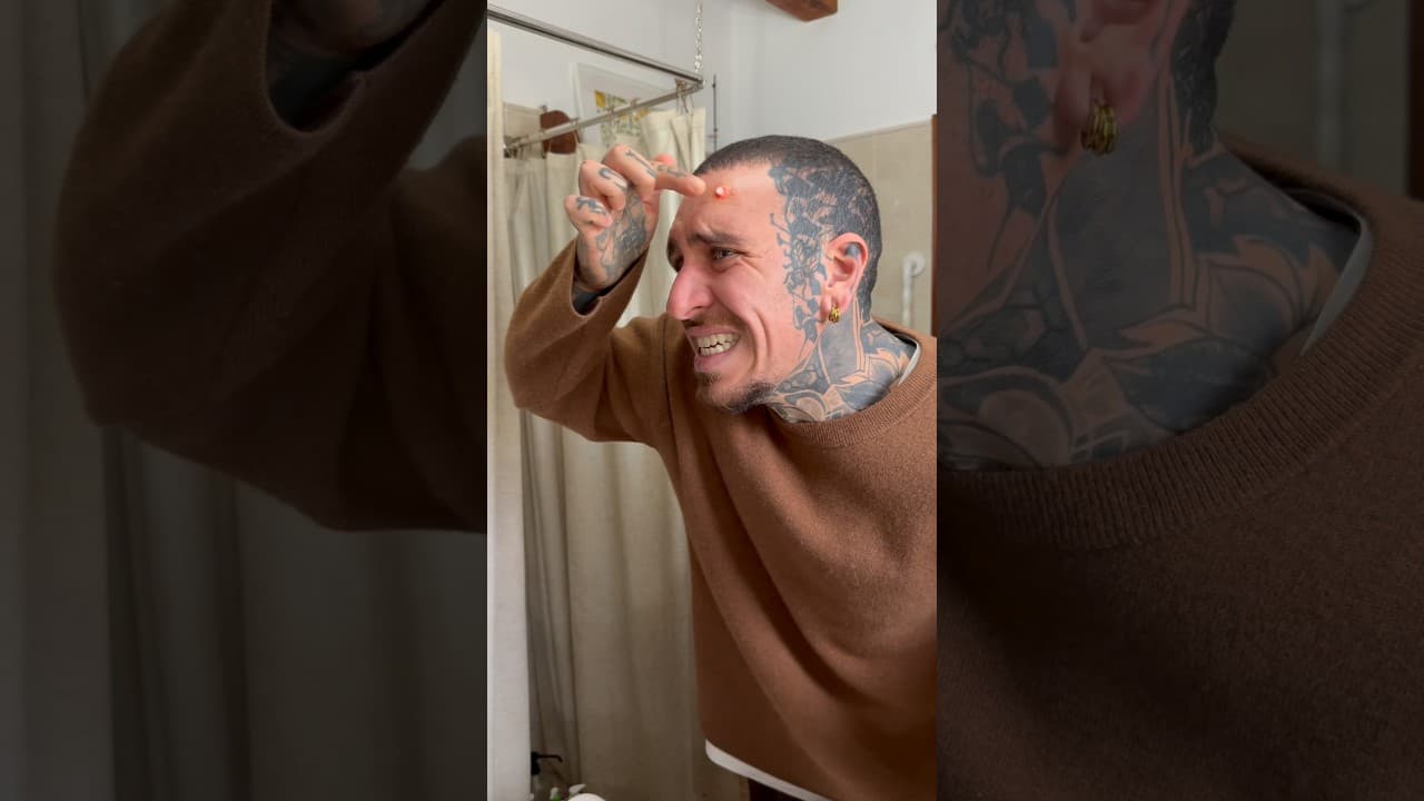 Pimple nightmare #skincare #shorts