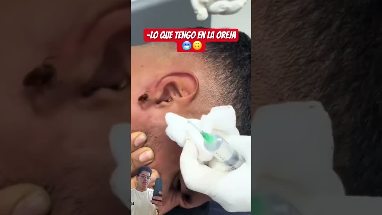 Yo me corto la oreja mejor 🥶😂😂 #humor #viral #fyp #parati #funny #shorts #reaction #oreja #animal