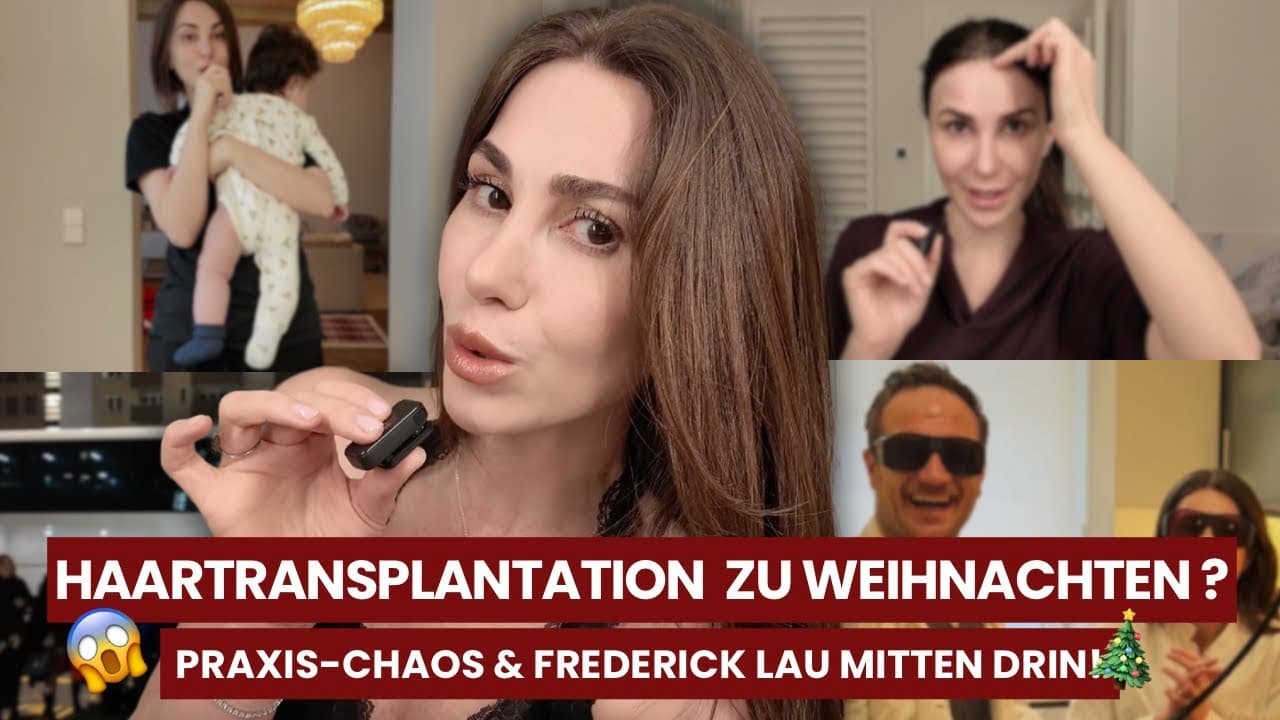 Weihnachtsfeier eskaliert + Ich bekomme eine Haartransplantation 😳 Frederick Lau zu Besuch!