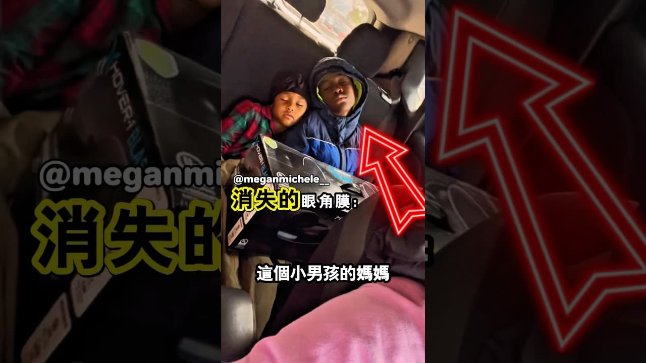 他認為他的腿上沒有任何東西😂